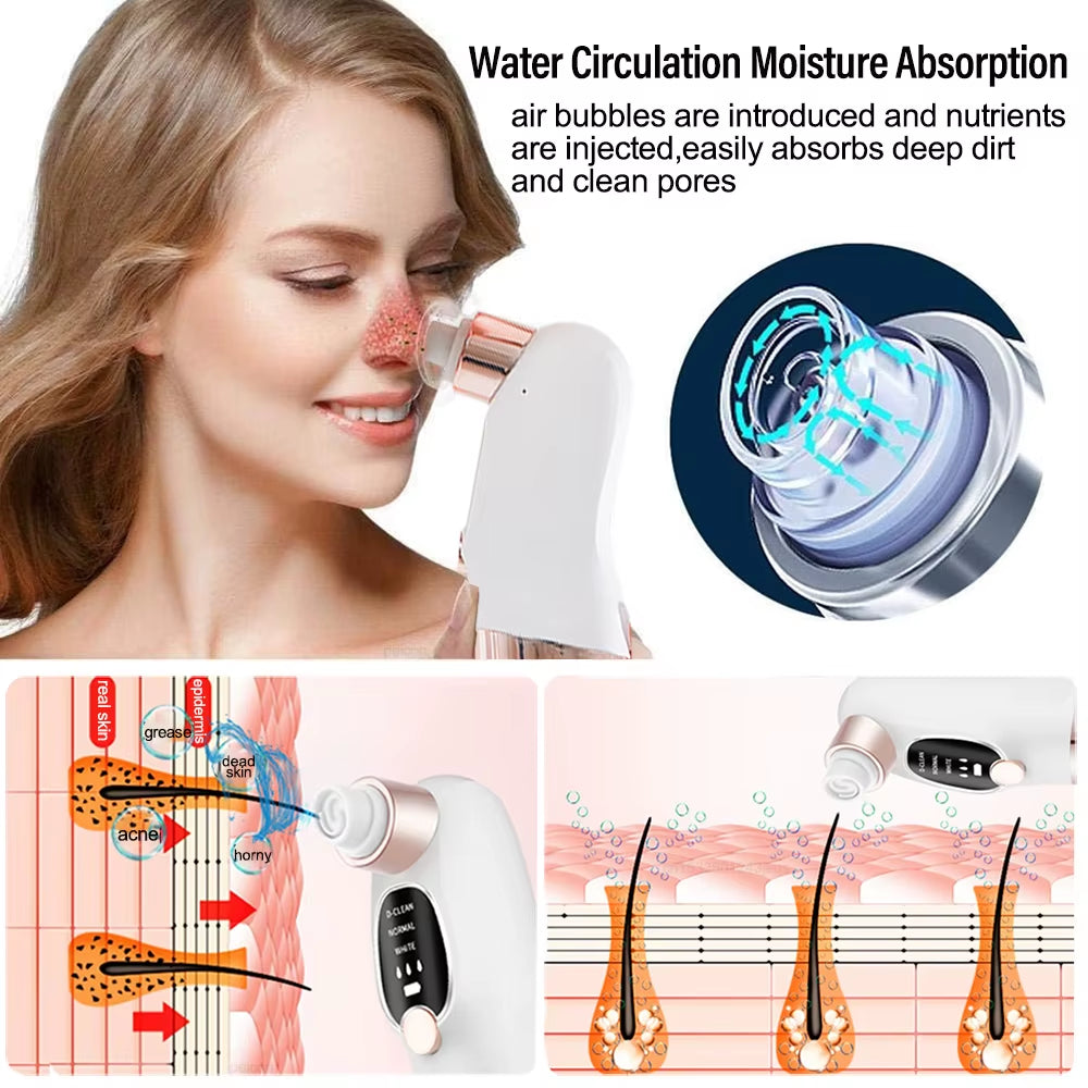 Electric Pore Vacuum Cleaner for Blackhead and Acne Removal