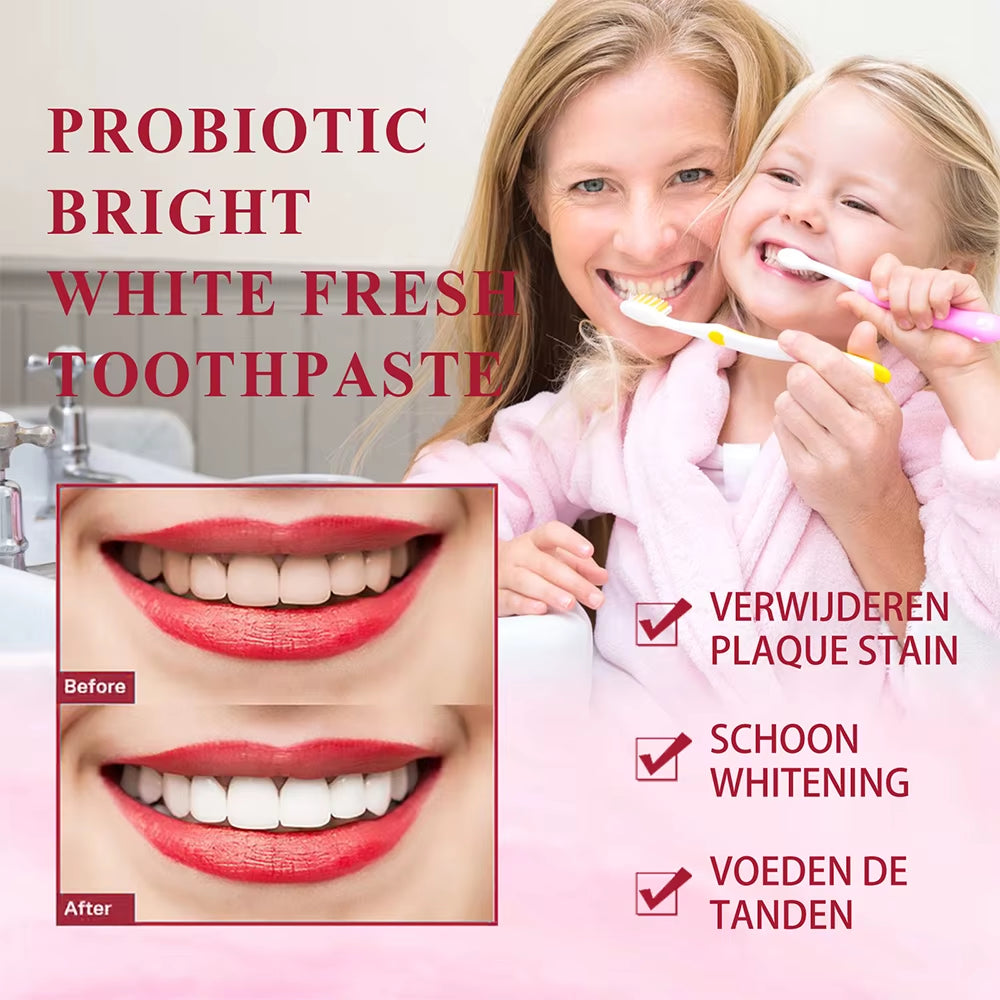 Probiotic Toothpaste Whiten Clean Teeth Remove Stains Management Fresh Breath with Sodium Saccharin Lactobacillus Oral Care