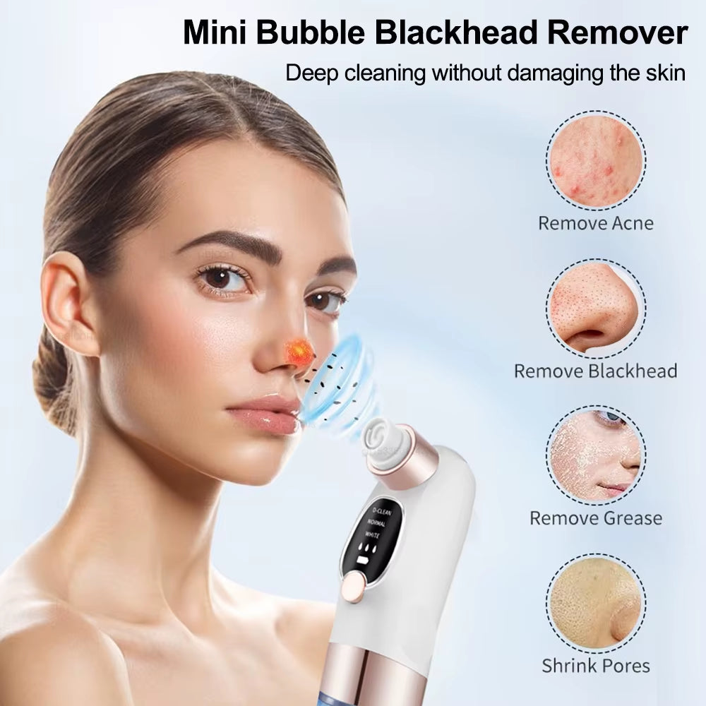 Electric Pore Vacuum Cleaner for Blackhead and Acne Removal