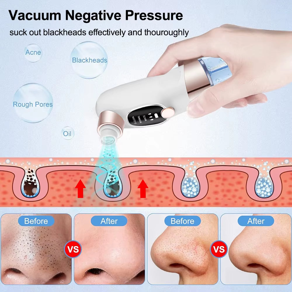 Electric Pore Vacuum Cleaner for Blackhead and Acne Removal