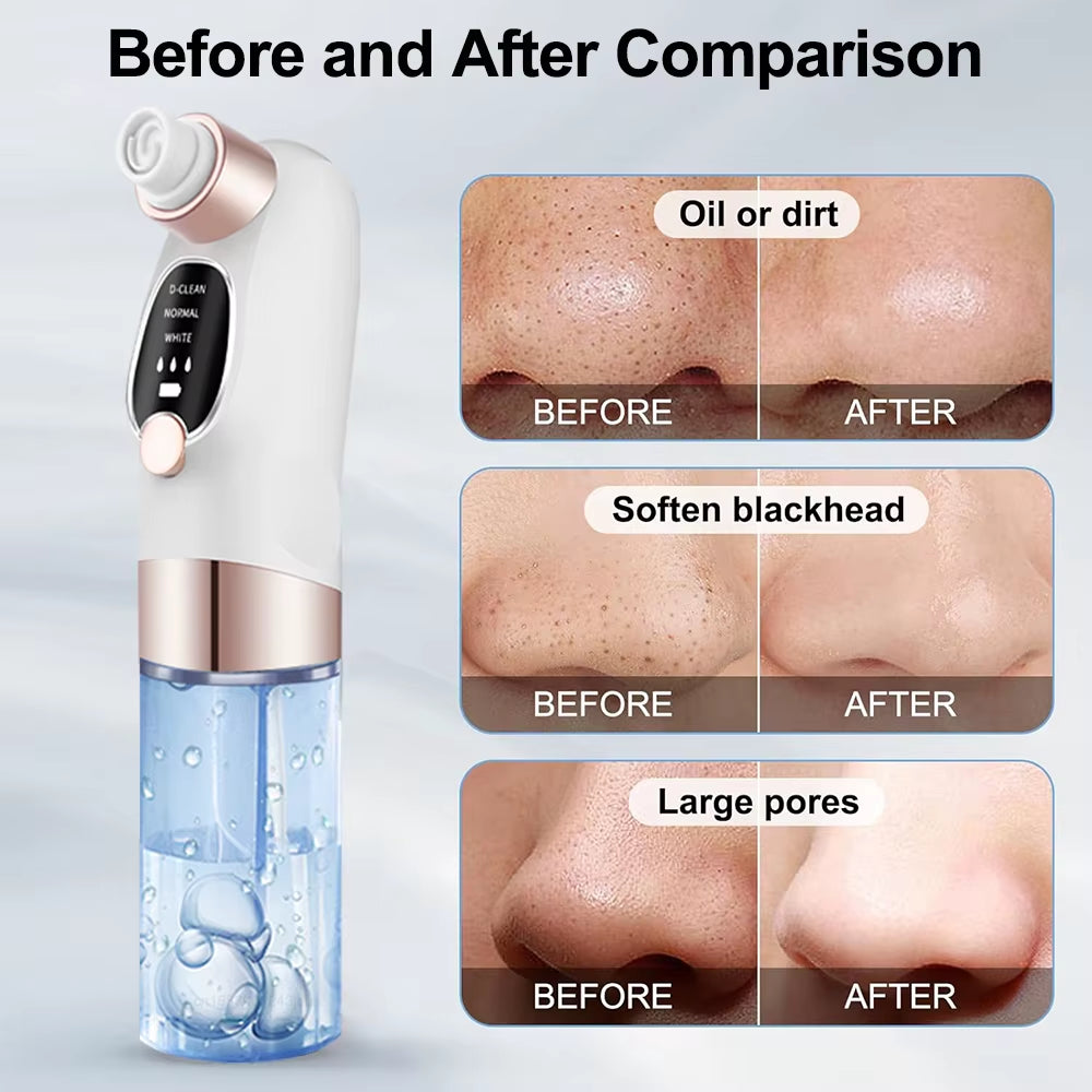 Electric Pore Vacuum Cleaner for Blackhead and Acne Removal