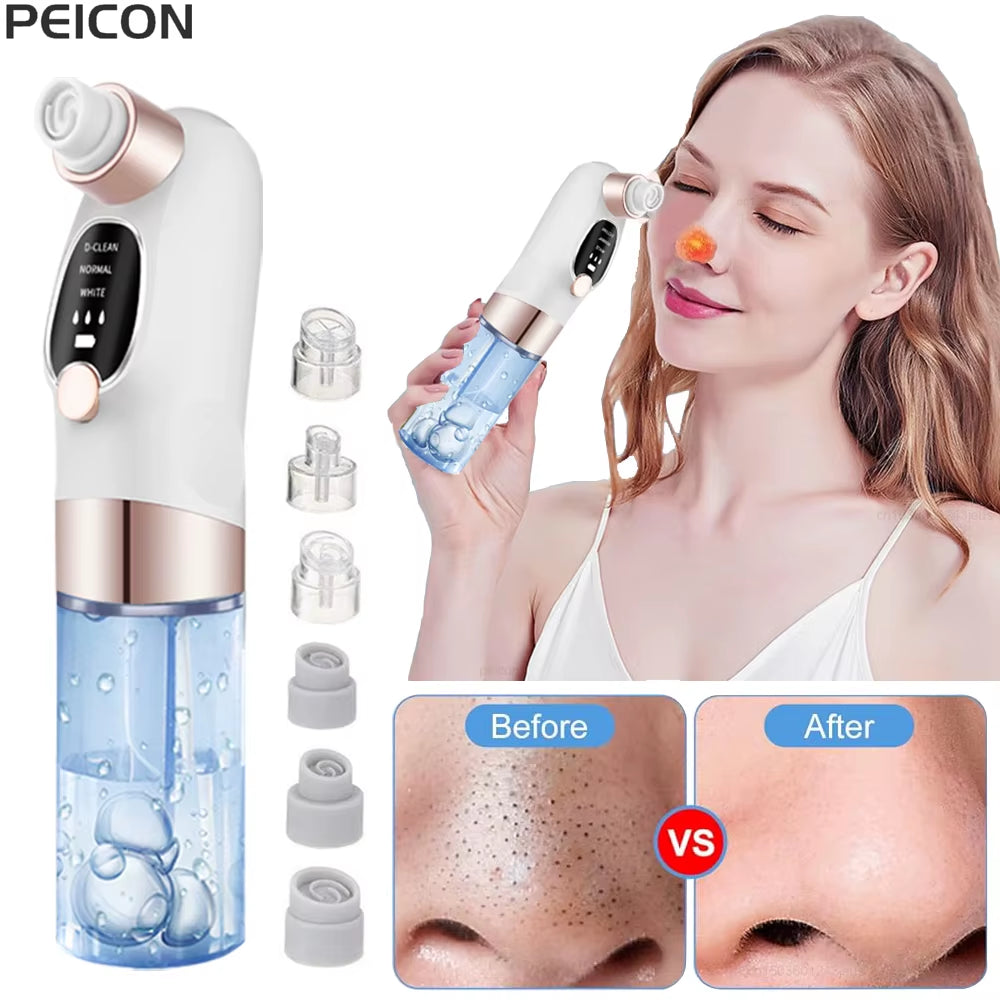 Electric Pore Vacuum Cleaner for Blackhead and Acne Removal